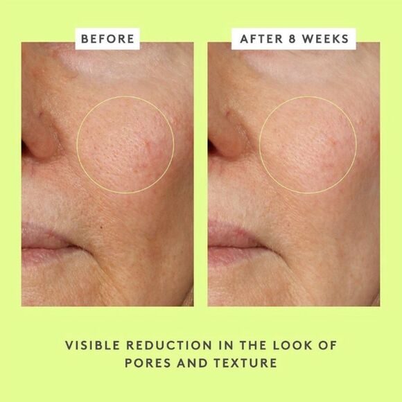 Drunk Elephant T.L.C. Framboos Glycolic Night Serum - 1.0 fl oz / 30 ml - Picture 5 of 5